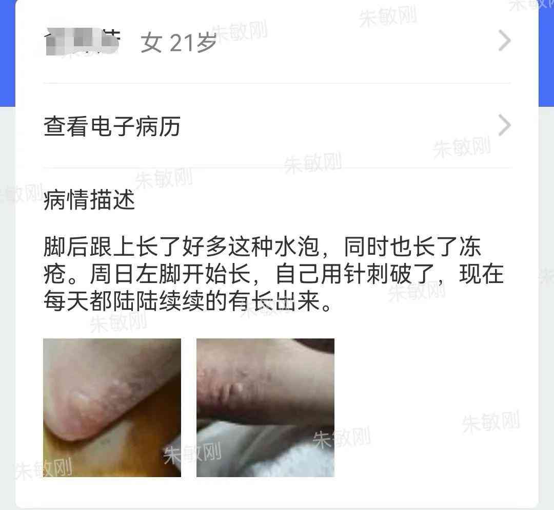 男人用千元化妆品擦脚可以吗(男人用化妆品有用吗)