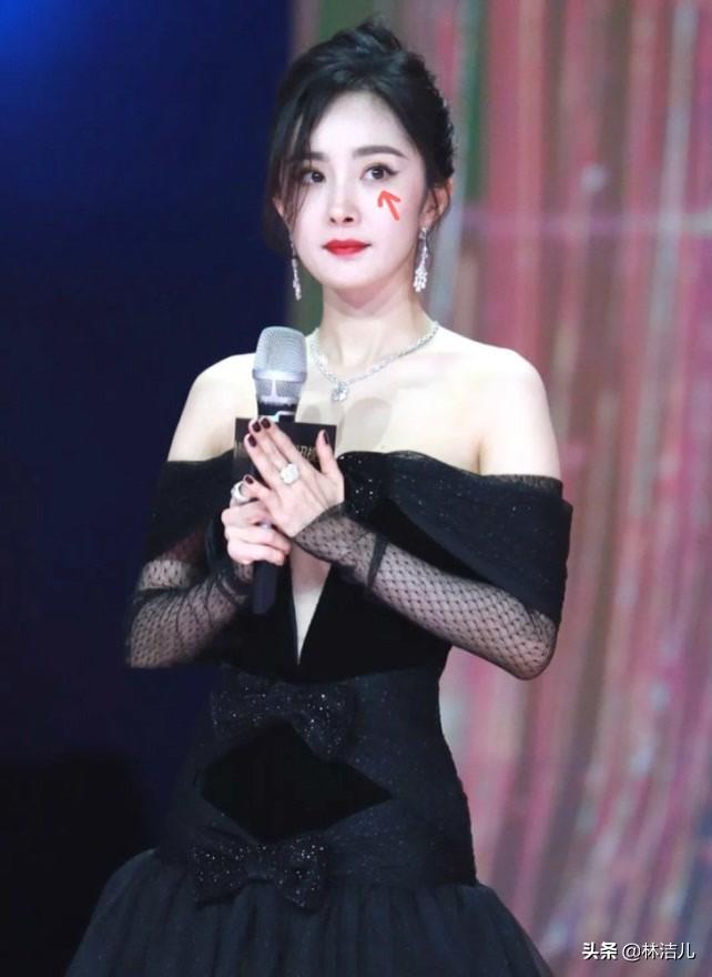 使用化妆品导致长斑怎么办(用化妆品之后形成黄褐斑怎么治疗)