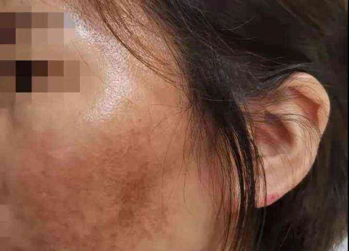 网购化妆品毁容事件(网购化妆品会传染新冠病毒吗)