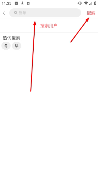 留影音乐相册解锁版