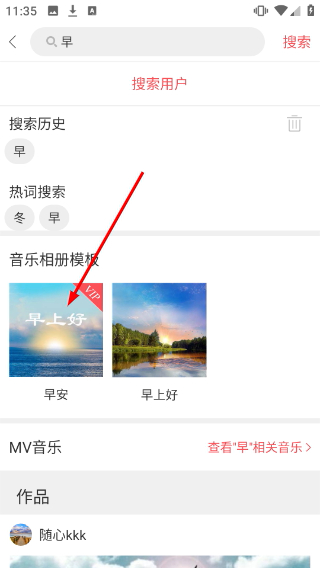 留影音乐相册解锁版