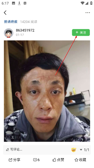 疤痕论坛