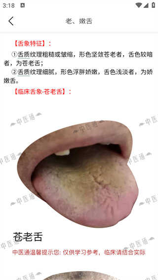中医通